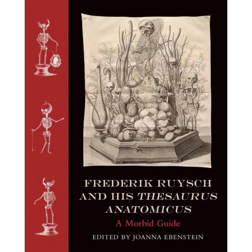 Frederik Ruysch and His Thesaurus Anatomicus A Morbid Guide