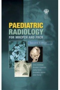 Paediatric Radiology for MRCPCH and FRCR, Second Edition
