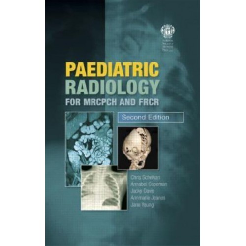 Paediatric Radiology for MRCPCH and FRCR, Second Edition