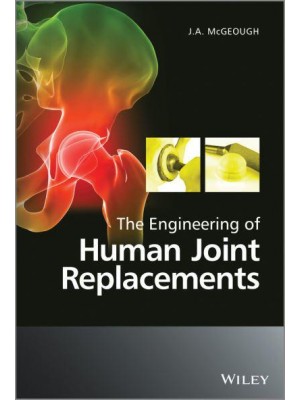 The Engineering of Human Joint Replacements