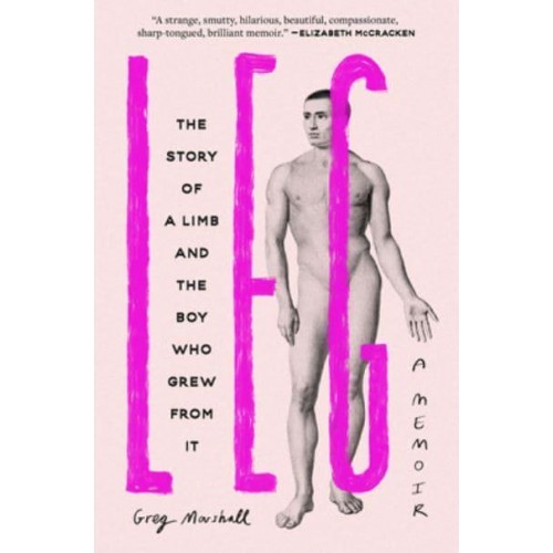 Leg The Story of a Limb and the Boy Who Grew from It