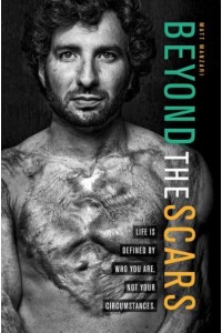 Beyond the Scars Life Is Defined by Who You Are, Not Your Circumstances
