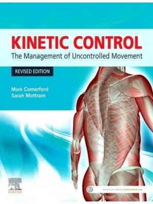 Kinetic Control The Management of Uncontrolled Movement