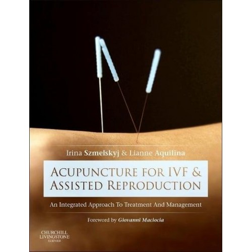 Acupuncture for IVF and Assisted Reproduction An Integrated Approach to Treatment and Management
