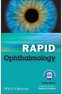 Rapid Ophthalmology - Rapid