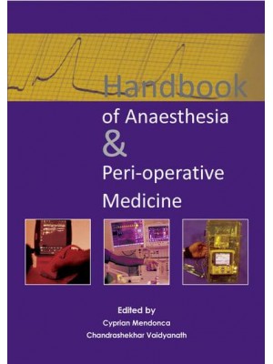 Handbook of Anaesthesia & Peri-Operative Medicine
