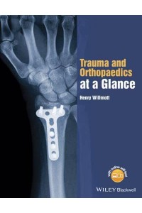 Trauma and Orthopaedics at a Glance - At a Glance Series