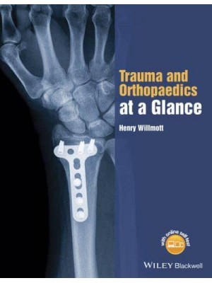 Trauma and Orthopaedics at a Glance - At a Glance Series