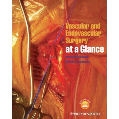 Vascular and Endovascular Surgery at a Glance - At a Glance