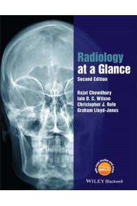 Radiology at a Glance - At a Glance