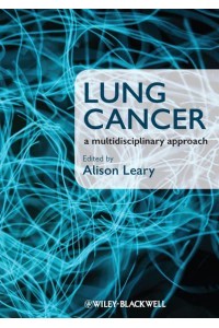 Lung Cancer A Multidisciplinary Approach