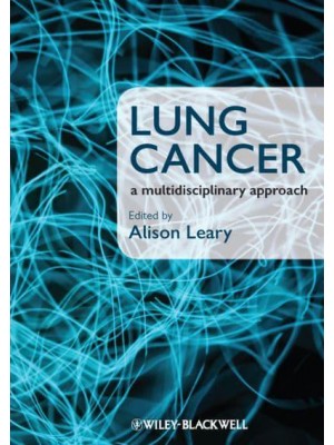 Lung Cancer A Multidisciplinary Approach