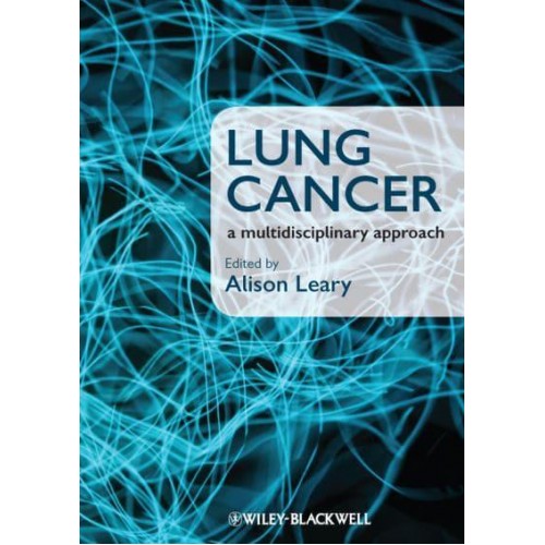 Lung Cancer A Multidisciplinary Approach
