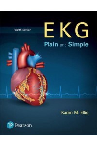 EKG Plain and Simple