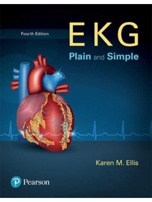 EKG Plain and Simple