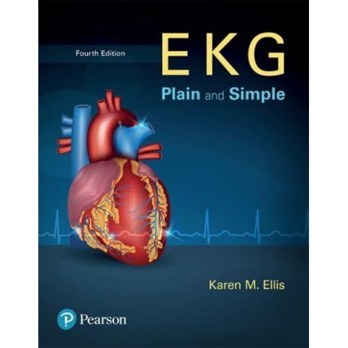 EKG Plain and Simple