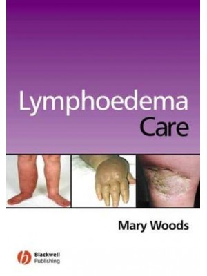 Lymphoedema Care