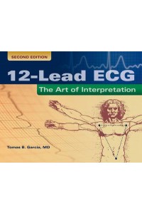 12-Lead ECG The Art of Interpretation