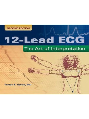 12-Lead ECG The Art of Interpretation