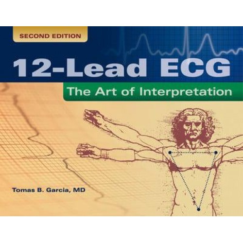 12-Lead ECG The Art of Interpretation
