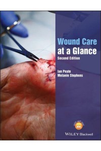 Wound Care at a Glance - At a Glance (Nursing and Healthcare)
