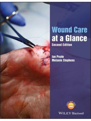 Wound Care at a Glance - At a Glance (Nursing and Healthcare)