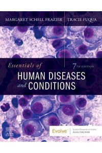 Essentials of Human Diseases and Conditions