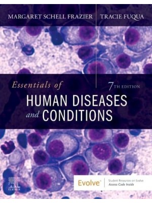 Essentials of Human Diseases and Conditions