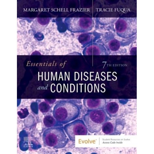 Essentials of Human Diseases and Conditions