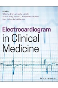 Electrocardiogram in Clinical Medicine