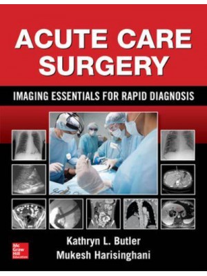 Acute Care Surgery Imaging Essentials for Rapid Diagnosis