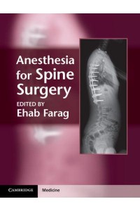 Anesthesia for Spine Surgery - Cambridge Medicine