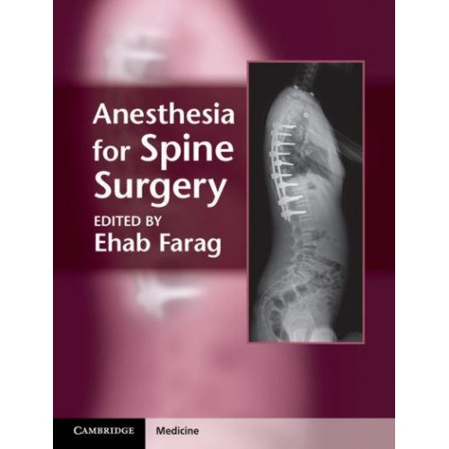 Anesthesia for Spine Surgery - Cambridge Medicine