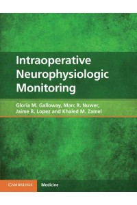 Intraoperative Neurophysiologic Monitoring - Cambridge Medicine