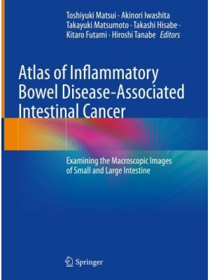 Atlas of Inflammatory Bowel Disease-Associated Intestinal Cancer Examining the Macroscopic Images of Small and Large Intestine