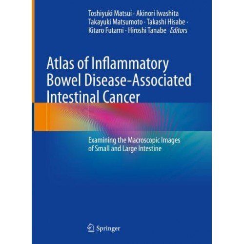 Atlas of Inflammatory Bowel Disease-Associated Intestinal Cancer Examining the Macroscopic Images of Small and Large Intestine