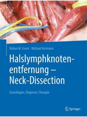 Halslymphknotenentfernung - Neck-Dissection Grundlagen, Diagnostik, Therapie