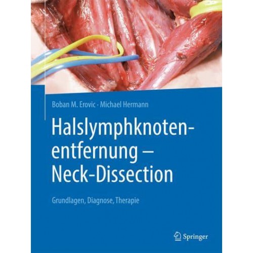 Halslymphknotenentfernung - Neck-Dissection Grundlagen, Diagnostik, Therapie