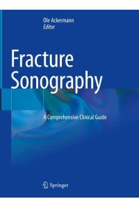 Fracture Sonography A Comprehensive Clinical Guide