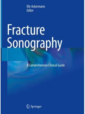 Fracture Sonography A Comprehensive Clinical Guide