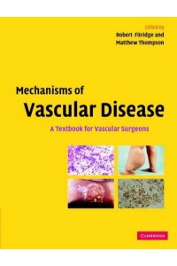 Mechanisms of Vascular Disease A Textbook for Vascular Surgeons