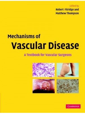 Mechanisms of Vascular Disease A Textbook for Vascular Surgeons