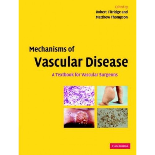 Mechanisms of Vascular Disease A Textbook for Vascular Surgeons