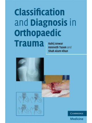 Classification and Diagnosis in Orthopaedic Trauma