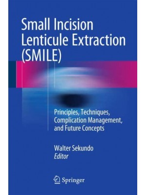 Small Incision Lenticule Extraction (SMILE) Principles, Techniques, Complication Management, and Future Concepts