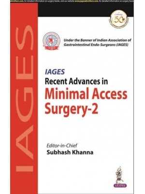 Recent Advances in Minimal Access Surgery-2