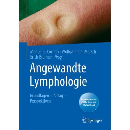 Angewandte Lymphologie Grundlagen - Alltag - Perspektiven