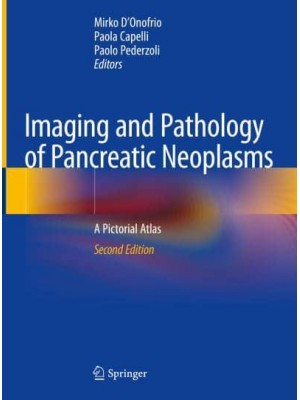 Imaging and Pathology of Pancreatic Neoplasms A Pictorial Atlas