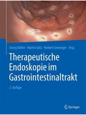 Therapeutische Endoskopie Im Gastrointestinaltrakt