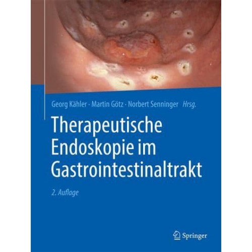 Therapeutische Endoskopie Im Gastrointestinaltrakt